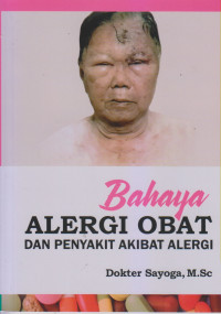 Bahaya Alergi Obat Dan Penyakit Akibat Alergi