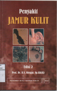 Image of Penyakit Jamur Kulit edisi 2